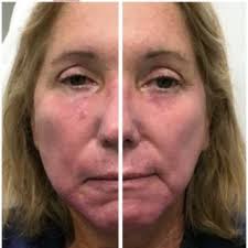 WoundCheck application screenshots. (A, B, C) The first step is the...