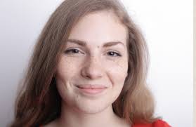 Sun and Age Spot Removal