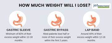 After that, the weight loss slows. Gastric Sleeve Vs Bypass Vs Lap Band Which Is Best Weight Loss Surgery