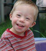 Welt-Down-Syndrom-Tag: Gezielte Information baut Berührungsängste ab