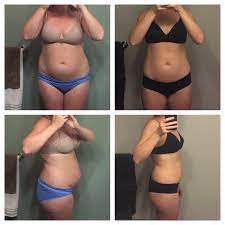 F 31 5 7 195lbs 142lbs 53lbs 6 Months Postpartum Weight Loss The Majority Was Lost In 10 Weeks Thanks To Ideal Protein Progresspics