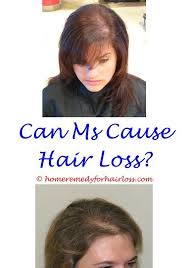 The royal society of chemistry publishing. Weight Loss Hair Loss Fatigue
