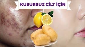 Kusursuz Cilt Icin Leke Giderici Yuz Beyazlatici Patates Limon Maskesi Tum Ciltler Icin Youtube Dogal Dogal Saglik Dogal Cilt Bakimi