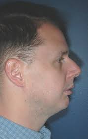 Convex Shorter Hairstyle And Bangs Over The Forehead Face Shapes Face Profile Jawline