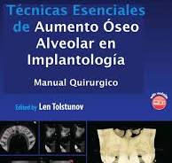 Técnicas Esenciales de Aumento Óseo Alveolar en ...