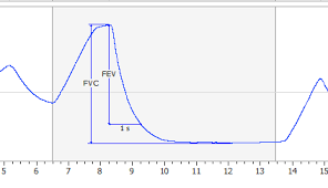 Spirometry Graph Analysis Respiratory Software Adinstruments