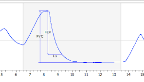 spirometry graph analysis respiratory software adinstruments