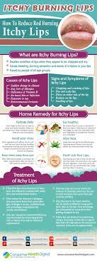 Itchy Burning Lips Home Remedies That Works Remedies Natural Remedies Home Remedies