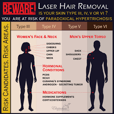 Other methods of body and facial hair removal can be ineffective or worse, counterproductive. About Laser Hair Removal Beware Of Laser Hair Removal