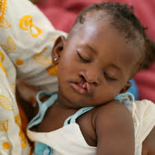 ReSurge International