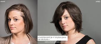 Coupe au carre les meilleurs modeles pour cheveux fins femme actuelle le mag from fac.img.pmdstatic.net. Le Volumateur De Cheveux Pour La Femme Avec Une Chevelure Clairsemee Specialiste Du Traitement De La Chute Des Cheveux Et De La Calvitie