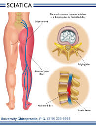 Pin On Patient Education