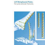 LCP Metaphyseal Plates. For juxta-articular fractures ...