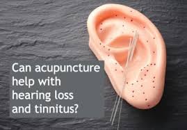 It is common and not usually a sign of anything serious. Acupuncture For Hearing Loss Or Tinnitus Will It Help