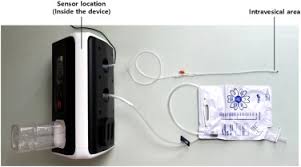 Image result for Bladder Irrigation