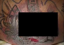 Maybe you would like to learn more about one of these? Man Dies From Infection After Going Swimming With A New Tattoo Health World News Asiaone