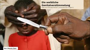 Vom englischen female circumcision fgm: Weibliche Genitalverstummelung By Dounia Ziani