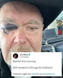 Child comes home with black eye