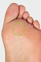 Hallux Valgus Schulthess Klinik