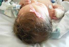 Il mio bambino neonato perde i capelli. Il Mio Bambino Neonato Perde I Capelli E Normale Bravi Bimbi