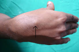 Image result for Trapezoid Bone