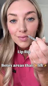 The art of the Botox lift💉✨ Our Nurse Practitioner and Lead Injector, Mikayla  Mueller, breaks down how strategic Botox can subtly lift the face