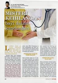 Bedanya di jaman dulu tak segampang itu, praktek bedah mayat manusia serba instan dan harus segera dilakukan hari itu juga agar tidak terjadi. 5 Bahan Ilmiah Manarah