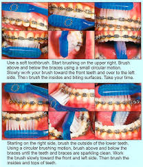 Floss your teeth every day. Brushing And Flossing Port Coquitlam British Columbia Innova Ortho