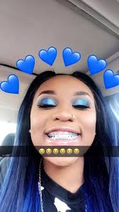 Black And Baby Blue Braces Pin Melaninmiracle Braces Colors Brace Face Cute Braces Colors