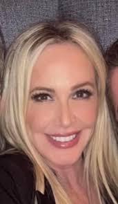 After seeing a recent episode of "Celebrity Family Feud" and I barely  recognized Kathy Swartz until I heard her voice. Early