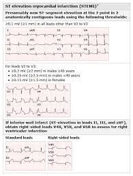 Image result for Chest Pain Observation Unit