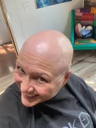 Breast Cancer Treatment and Hair Loss Experience