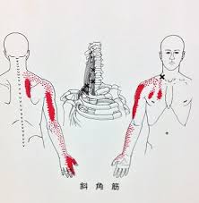手のしびれの原因、斜角筋のトリガーポイントについて | 右京区平川接骨院/鍼灸治療院グループ