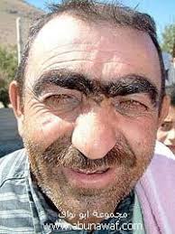 ما حكم ازالة الشعر من منطقة ما بين الحاجبين موقع عربي أمريكي