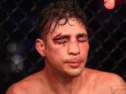 Diego sanchez is a ufc fighter from albuquerque, new mexico. Joshua Fabia On Sanchez Split Diego Has Clearly Been Taking Advantage Of Me For Two Years Bloody Elbow