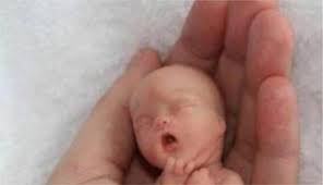 A complete list of abortion medicines in the norveç with instructions, dosage, and route of administration. Fake Foetus Pic Inflames Norway Abortion Debate The Local