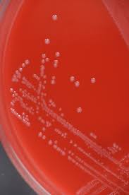Image result for Group B Streptococcus