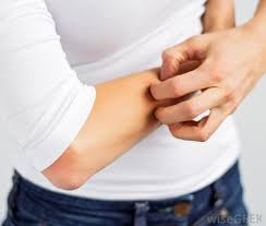 As an additive used in glass manufacture, rubber production zinc oxide is also used in skin protectants, such as diaper rash ointments and sunscreen products. What Is Zinc Ointment With Pictures