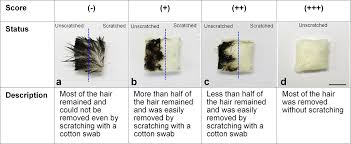 Image result for HAIR Score