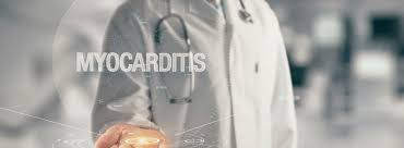 ¿qué es, síntomas, a quién afecta y diferencias con la pericarditis? Miocarditis Que Es Y Sintomas Canalsalud