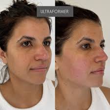 Tayna Smith (@taynabeautystudio) · Dracut, MA