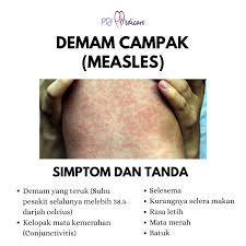 Selain itu, kekebalan tubuh bayi yang belum. Demam Pusat Rawatan Impian Pri Medicare Sdn Bhd Facebook