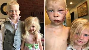 Quarterback trevor lawrence is the no. Brave Boy 6 Left Disfigured After Saving Sister From Dog Attack