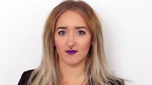 Brynn, 3, har bara ett öga