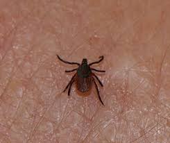 What You Should Know About Lyme Disease In Washington Washingtonian Dc