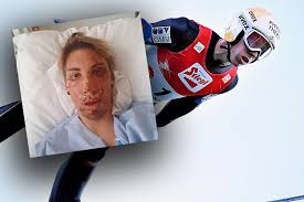 November 2020 und wird voraussichtlich bis zum 28. Thomas Diethart Schockt Mit Krankenhaus Foto Skispringen Com