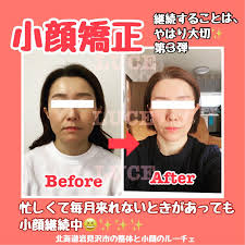 整体と小顔矯正サロンルーチェ