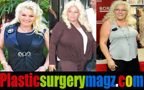 Ann margret reportedly got bad plastic surgery so that her appearance now looks worse than she used to.she looks so different and almost unrecognizable anymore. Beth Chapman Plastic Surgery Before And After Pictures Plastic Surgery Magazine