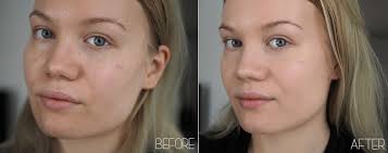 For many women, traditional makeup works well and often gives. Acne Archives Page 9 Of 10 Charlotta Eve