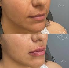 ✨ Meet Brigid Moriarty, RN, BSN, CANS ✨ We're thrilled to welcome Brigid to  the team! As a Certified Aesthetic Nurse Specialist, she brings years of  experience and a passion for natural,